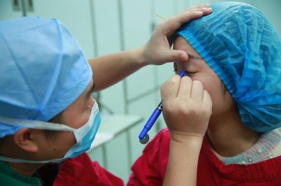 深圳陽光醫(yī)院雙眼皮一個月恢復(fù)圖 日記見證蛻變