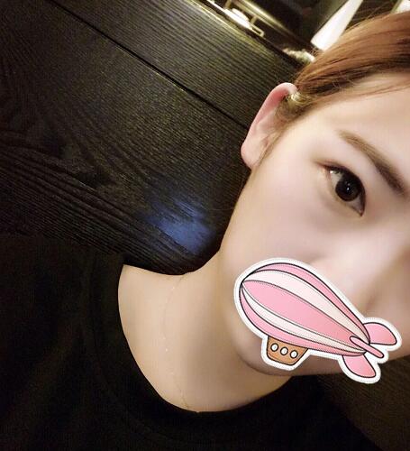 重慶五洲整形醫(yī)院醫(yī)生技術(shù)口碑|雙眼皮案例實記分享