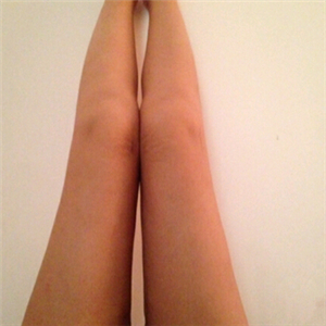 去找東方和諧馮斌做了大腿抽脂，分享一下果吧！