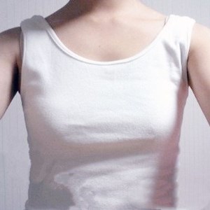 廣元美華楊林醫(yī)生做的自體脂肪隆胸，兩個月的果圖片分享~