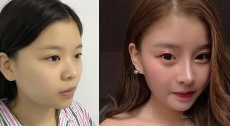 好消息!南寧華美10月20-21日邀請(qǐng)廖連平、劉志剛和徐艦來(lái)院坐診~