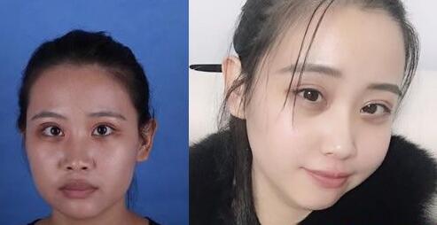 好消息!南寧華美10月20-21日邀請(qǐng)廖連平、劉志剛和徐艦來(lái)院坐診~