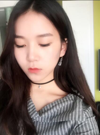 山東省立醫(yī)院光纖溶脂瘦臉前后果片日記手札