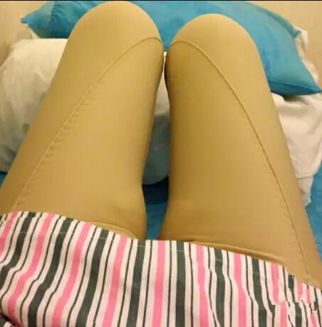 哈醫(yī)大二院整形科徐學(xué)武大腿吸脂術(shù)前后恢復(fù)分享手記