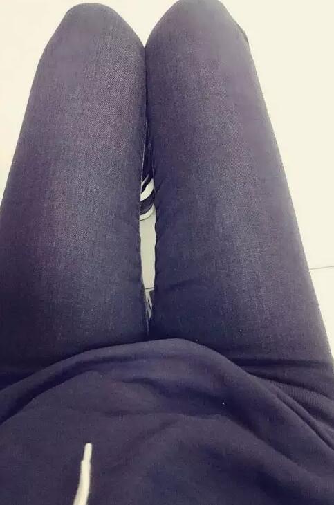 哈醫(yī)大二院整形科徐學(xué)武大腿吸脂術(shù)前后恢復(fù)分享手記