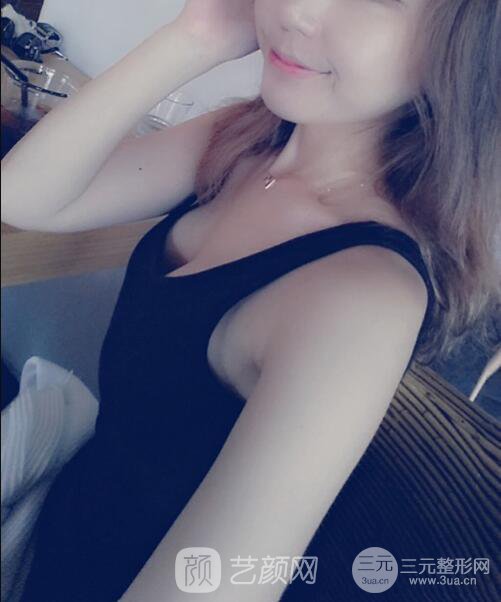 北京隆胸抽脂多少錢(qián)?北京東方和諧自體脂肪豐胸案例