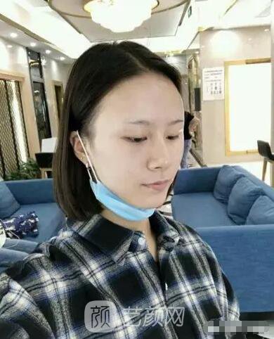 北京上上相鄭楚蓉院長自體脂肪填充全臉圖心情小記