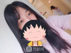 成都嬌點姜宇祿雙眼皮修復案例，重獲新生！