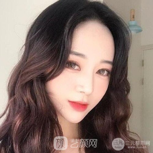 上海華美楊亞益主任做的芭比雙眼皮，果很好哦~