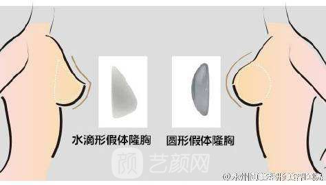 【韓式吸脂隆胸的費(fèi)用多少？韓式吸脂隆胸費(fèi)用的影響因素？】