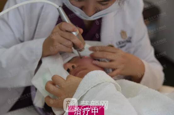 皮-秒激光祛斑案例，恢復(fù)照片分享~