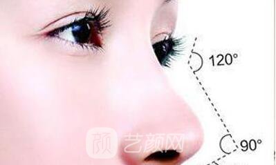 重慶微晶瓷隆鼻價(jià)格多少?微晶瓷隆鼻價(jià)格影響因素~