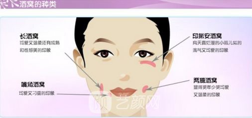 人造酒窩貴嗎?需要多少錢?