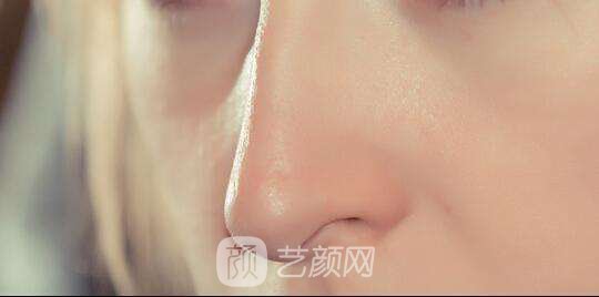 北京做修復鼻子需要多少錢？