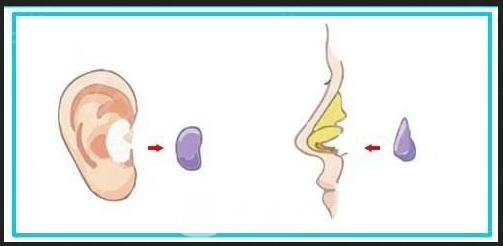 上海耳軟骨墊鼻尖多少錢?
