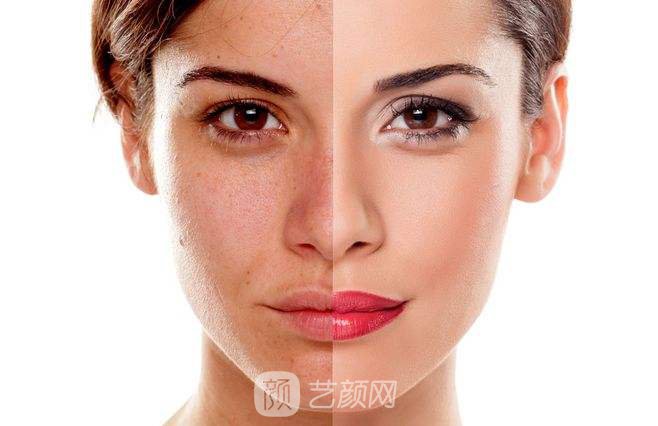 北京注射瑞藍(lán)玻尿酸多少錢?