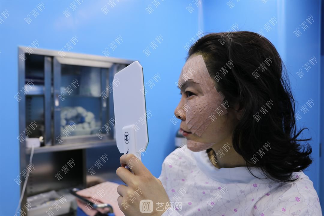 杭州新清吟陳永自體脂肪面部填充+注射瘦臉除皺案例直播~