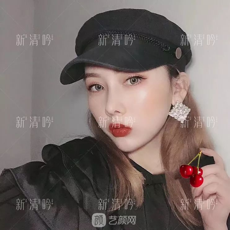 耳軟骨隆鼻果怎么樣？案例照片一覽~