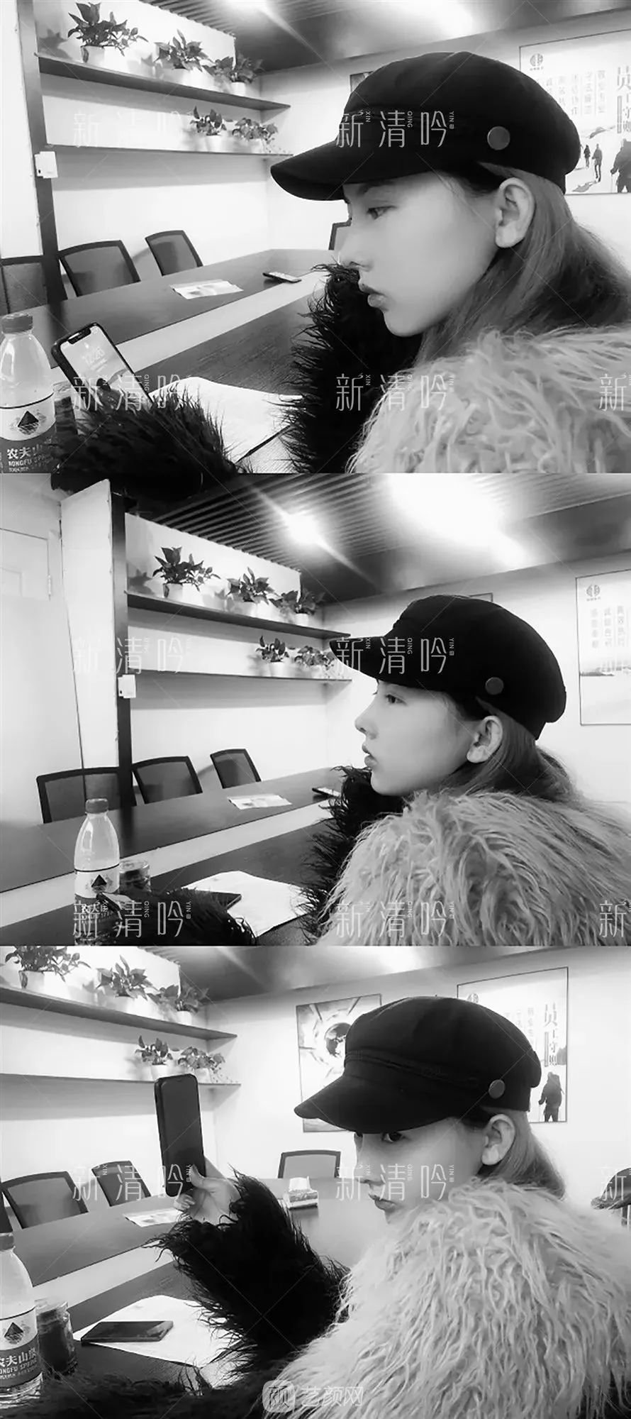 耳軟骨隆鼻果怎么樣？案例照片一覽~