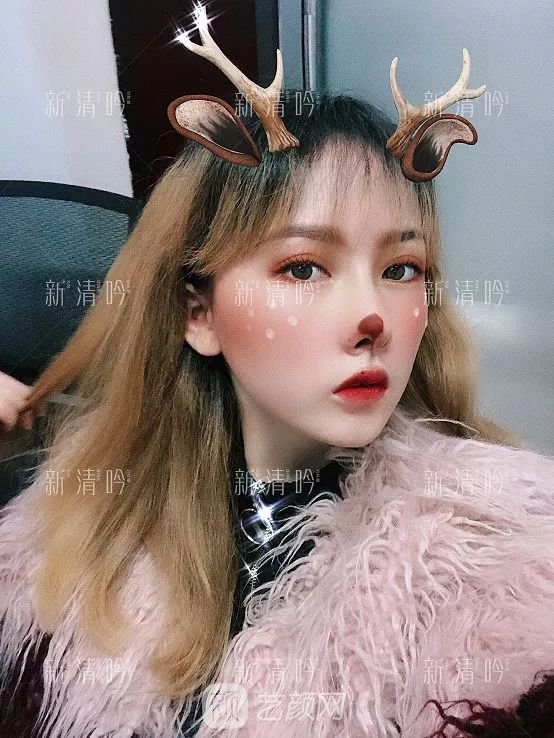 耳軟骨隆鼻果怎么樣？案例照片一覽~