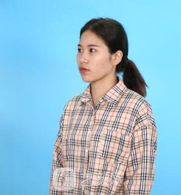 開眼角圖真實(shí)案例分享哦