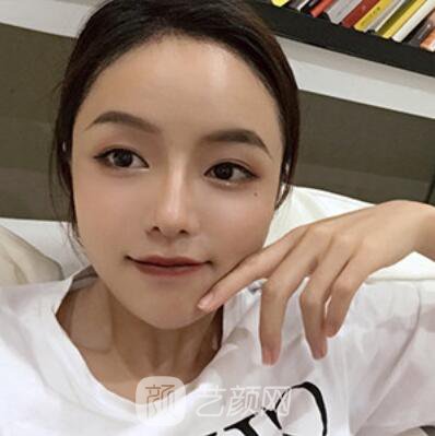 做好發(fā)際線后堪比微調(diào)的真實(shí)經(jīng)歷分享