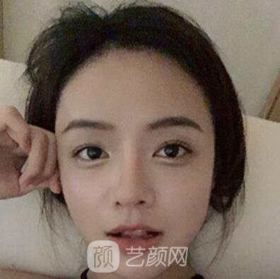 做好發(fā)際線后堪比微調(diào)的真實(shí)經(jīng)歷分享