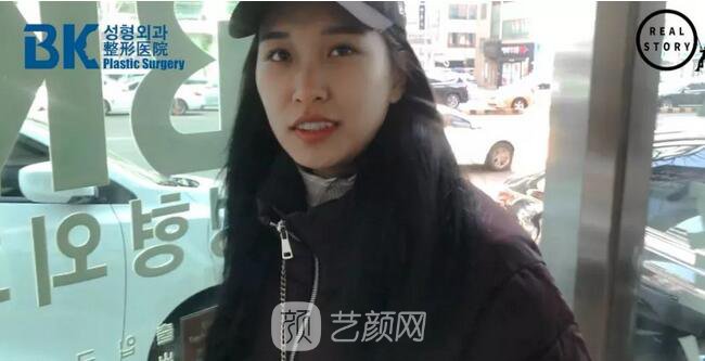 【新西蘭美女整形日記】鼻部手術(shù)+面部脂肪移植——BK整形醫(yī)院