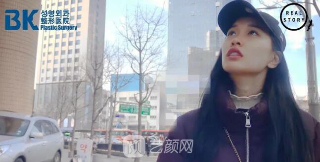 【新西蘭美女整形日記】鼻部手術(shù)+面部脂肪移植——BK整形醫(yī)院