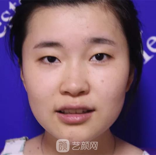 出道三年，她整成這樣終于亮相芒果臺啦！