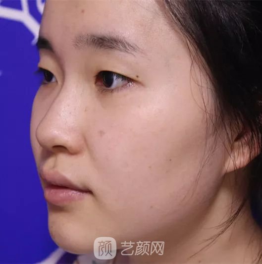 出道三年，她整成這樣終于亮相芒果臺啦！