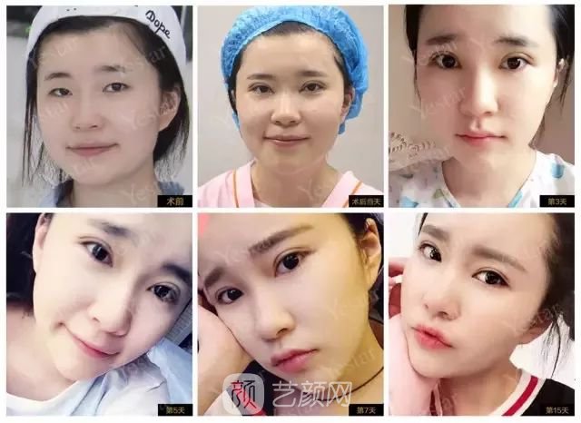 出道三年，她整成這樣終于亮相芒果臺啦！