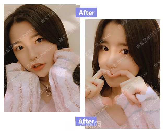 出道三年，她整成這樣終于亮相芒果臺啦！