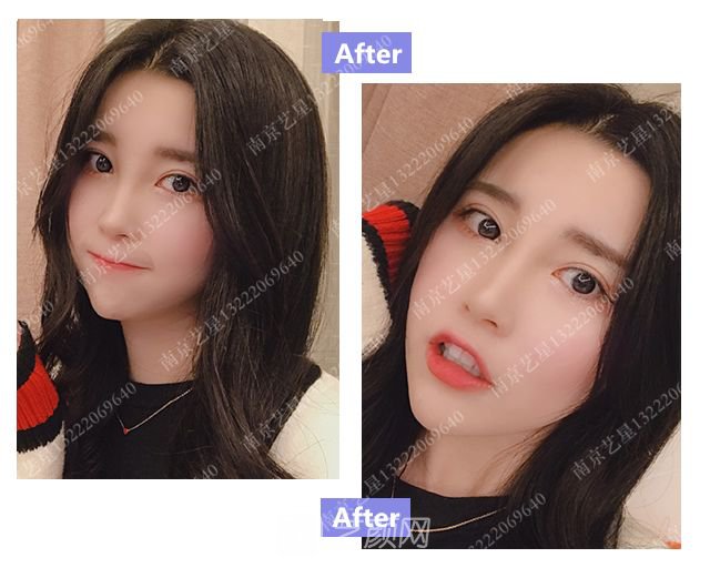 出道三年，她整成這樣終于亮相芒果臺啦！