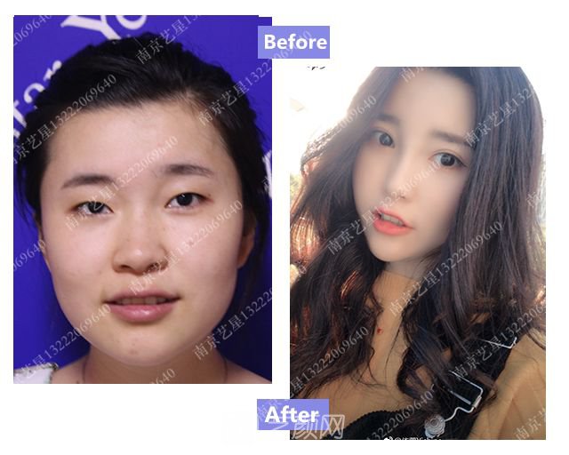 出道三年，她整成這樣終于亮相芒果臺啦！