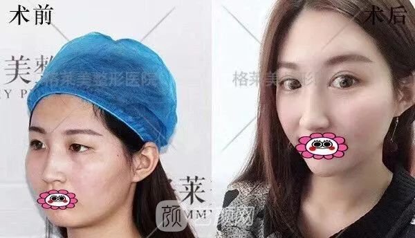 福州格萊美跨年造美節(jié)開始啦，四重好禮送不停，5人同行項(xiàng)目5折起~