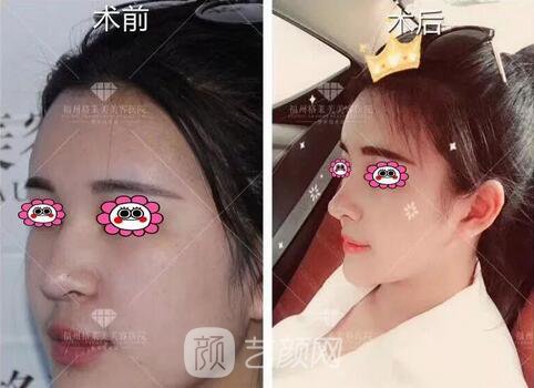 福州格萊美跨年造美節(jié)開始啦，四重好禮送不停，5人同行項(xiàng)目5折起~