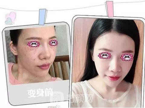 福州格萊美跨年造美節(jié)開始啦，四重好禮送不停，5人同行項(xiàng)目5折起~