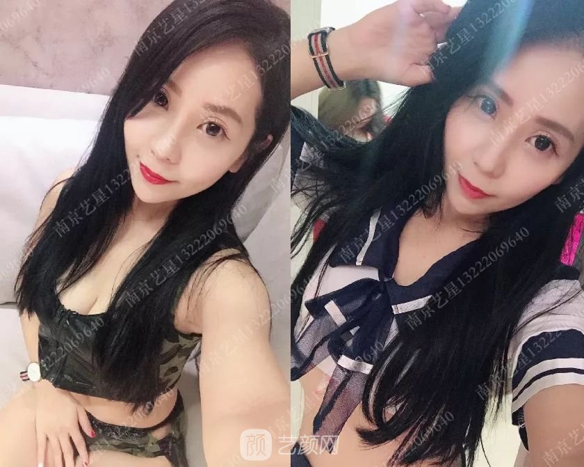 只需要5分鐘，我的鼻子變高了！——南京藝星玻尿酸隆鼻~