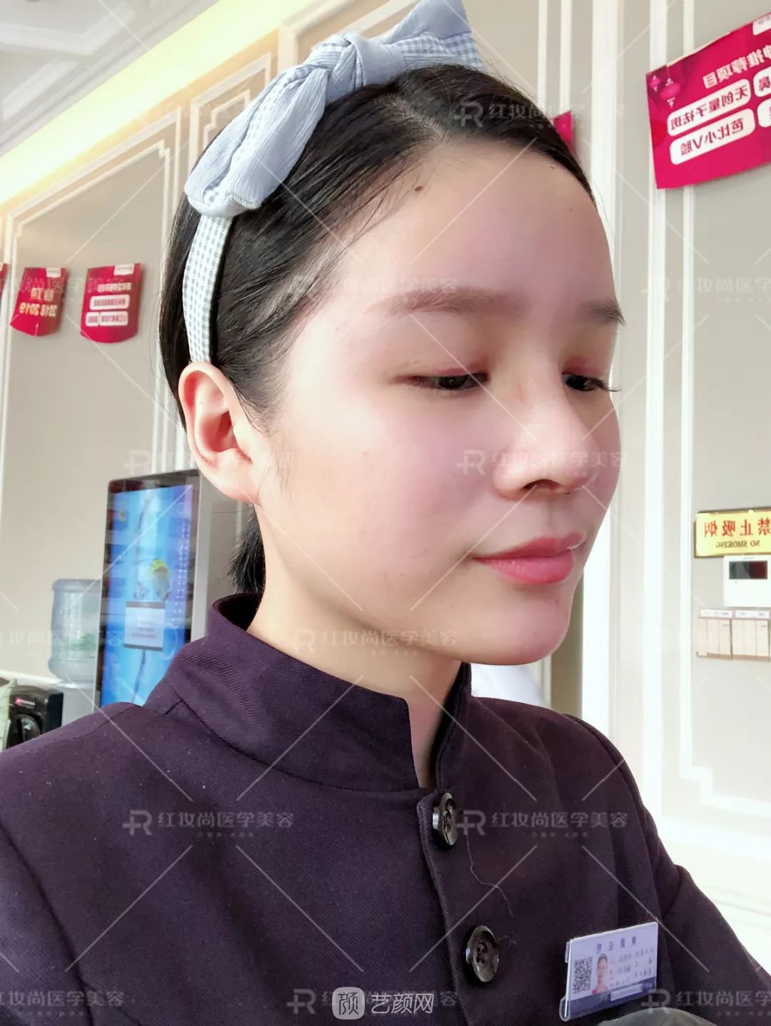 【蛻變?nèi)沼洝拷^美側(cè)顏的秘密——分享我的美鼻之旅~