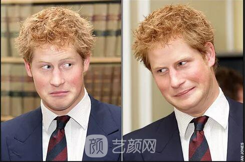 徐崢回應(yīng)脫發(fā)、英國小刺猬因壓力大脫毛！不得不說“禿”真是不分界的...