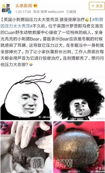 徐崢回應(yīng)脫發(fā)、英國小刺猬因壓力大脫毛！不得不說“禿”真是不分界的...