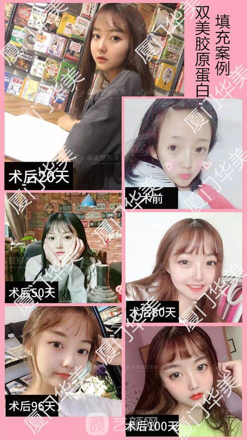 不用工具，10秒自測(cè)肌膚年齡的方法在這，戳我！