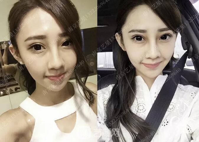 眼霜不管用，拿什么拯救你我的淚溝~