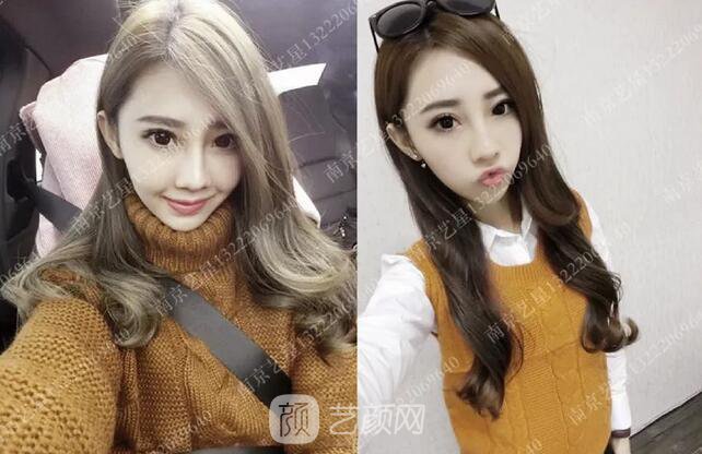 眼霜不管用，拿什么拯救你我的淚溝~