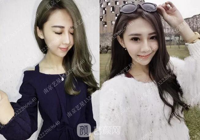 眼霜不管用，拿什么拯救你我的淚溝~