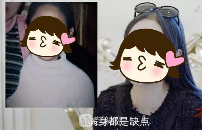 【竟因一件衣服決定整容！她的現(xiàn)狀如何？】