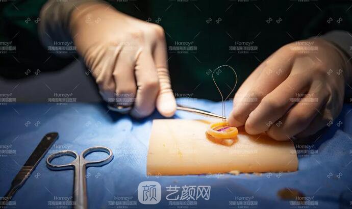 【取肋軟骨會影響孩子胸廓發(fā)育嗎？】