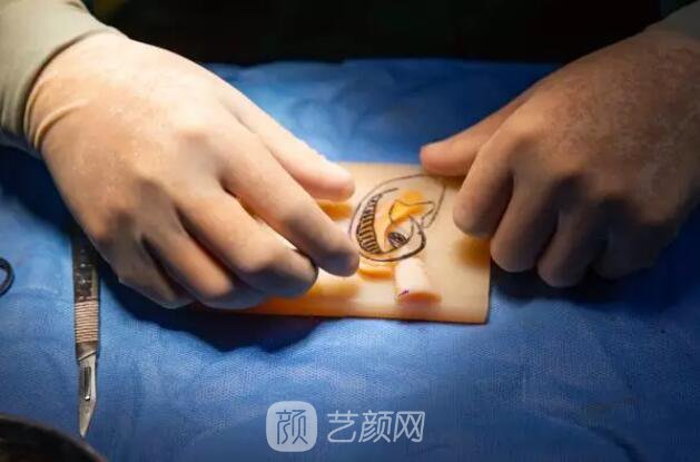 【再造的耳朵軟硬度摸起來和正常耳朵一樣嗎？】