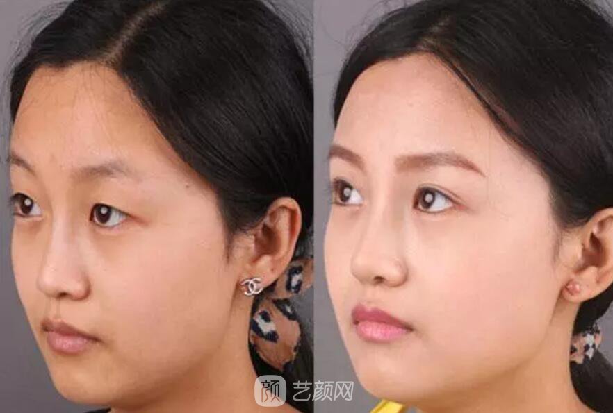 曾經(jīng)被我嘲笑的小眼睛室友，如今變得艷壓群芳？！